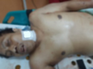 Pria Korban Pembacokan di Bekasi Ternyata Sopir Taxi Online