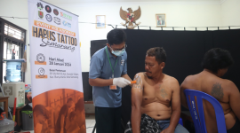 Suasana Hapus Tato Massal