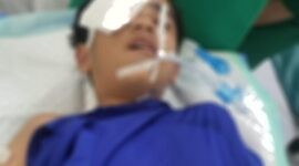 Foto: Korban Gery Bocah Bersuaia 11 tahun
